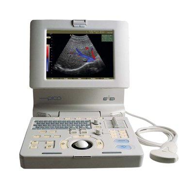 Medison&#039;s SonoAce Pico Portable Ultrasound Machine
