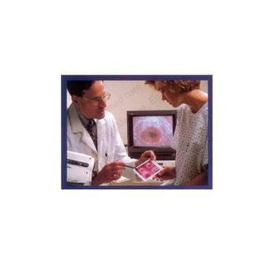 Welch Allyn Welch Allyn Video Colposcope