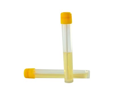 Liquid Media Vials