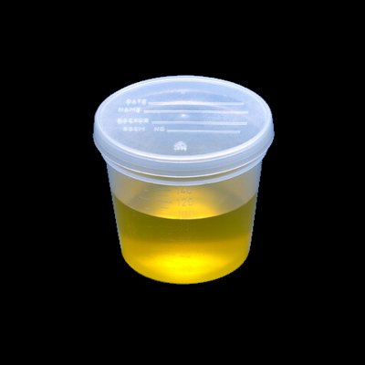 5oz Specimen Containers