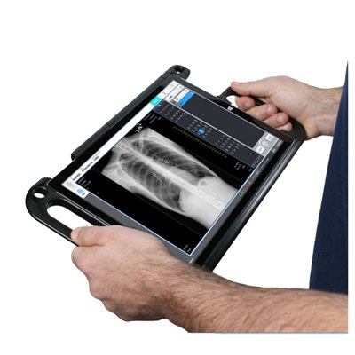 Maxtec AccuVue X-Ray Acquisition Software