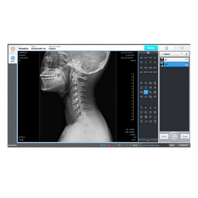 Maxtec AccuVue X-Ray Acquisition Software